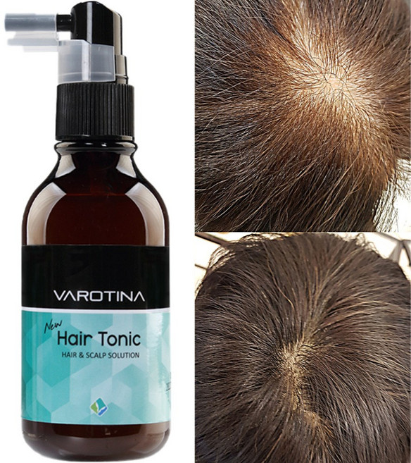 바로티나 탈모증상완화 두피 기능성 토닉 앰플, 100ml, 1개