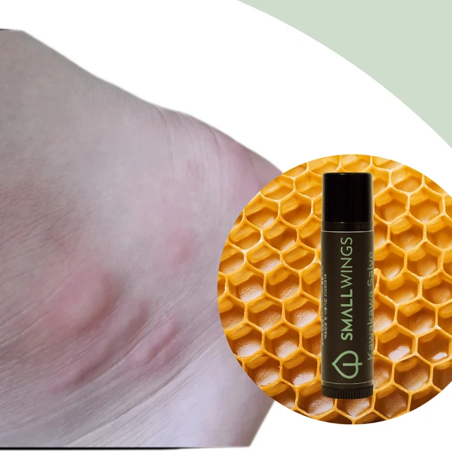 스몰윙즈 카와카와살브 카밍 온더고 / 모기와의 전쟁에서 승리하세요! 세상 모든 가려움을 잡아드립니다., 4.5g, 2개 - 쿠팡