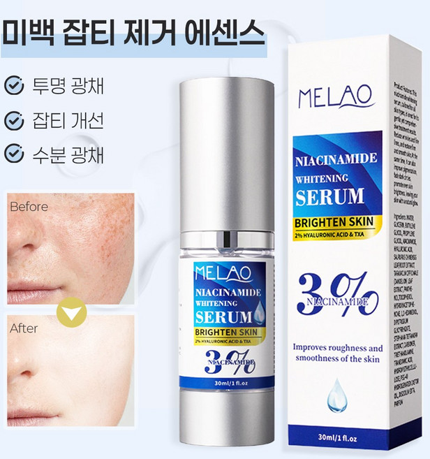 미백 기미 잡티 제거 에센스 나이아신아마이드 에센스 각종 기미 잡티 제거 멜라닌 색소 완화 톤업 및 미백 트라넥삼산 세럼 미백 수분 보습, 1개, 30ml