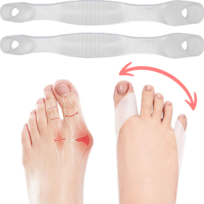 네버폴드 실리콘 무지외반증 발가락 교정기 초경량 외출겸용, 1세트