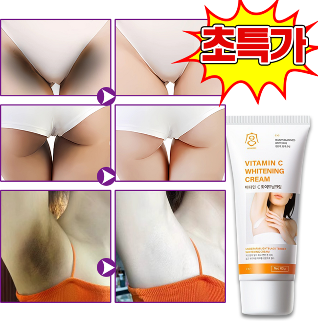 착색크림 y존 착색 겨드랑이 색소침착 미백크림 아젤리아 크림 팔꿈치 착색제거 크림 화이트닝 바디 톤업크림, 1개, 60g