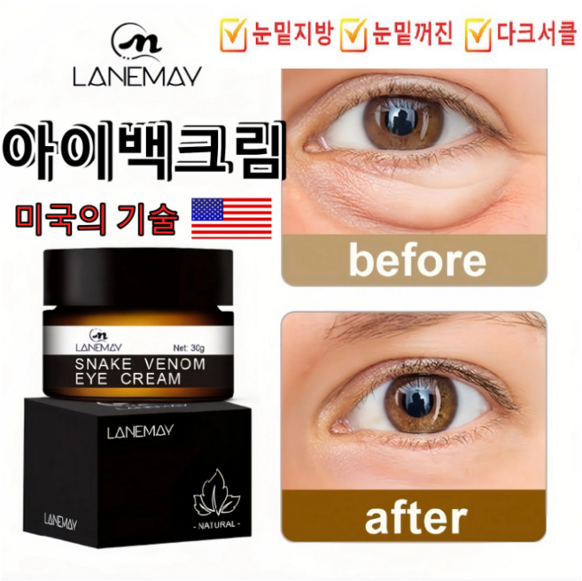 눈밑지방제거 눈밑꺼짐 눈밑지방 아이백 리프팅 아이크림 눈 밑 지방 볼륨 아이크림 다크서클 눈밑꺼짐 눈밑주름 제거 아이백 크림, 30g, 3개