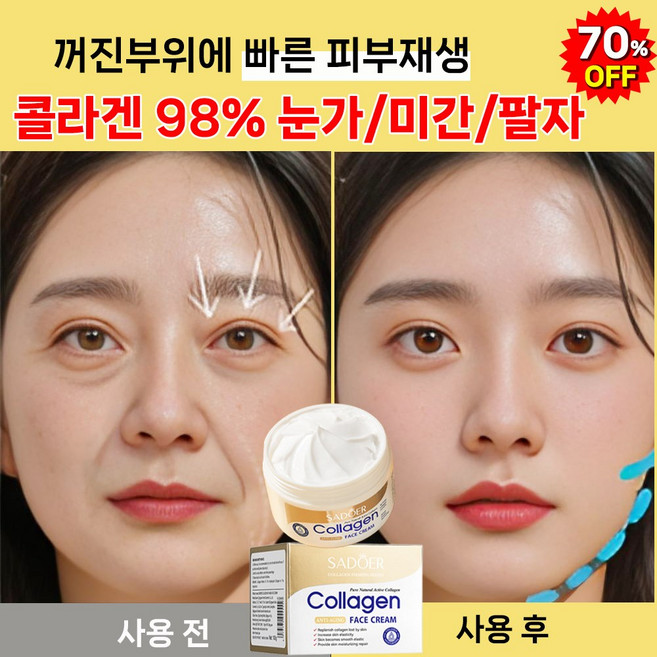 [콜라겐 99%] 1/1+1 콜라겐 저분자 크림 얼굴 팔자 미간 주름 피부 탄력 케어 리프팅 주름 개선 크림, 1개, 100g