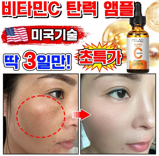 [100%제거] 1/1+1/2+2 비타민C 세럼 비타민 미백 앰플 기미 잡티 제거 에센스 비타씨플러스 잡티씨 탄력앰플 화이트닝 모공 수축, 1개, 30ml - 쿠팡
