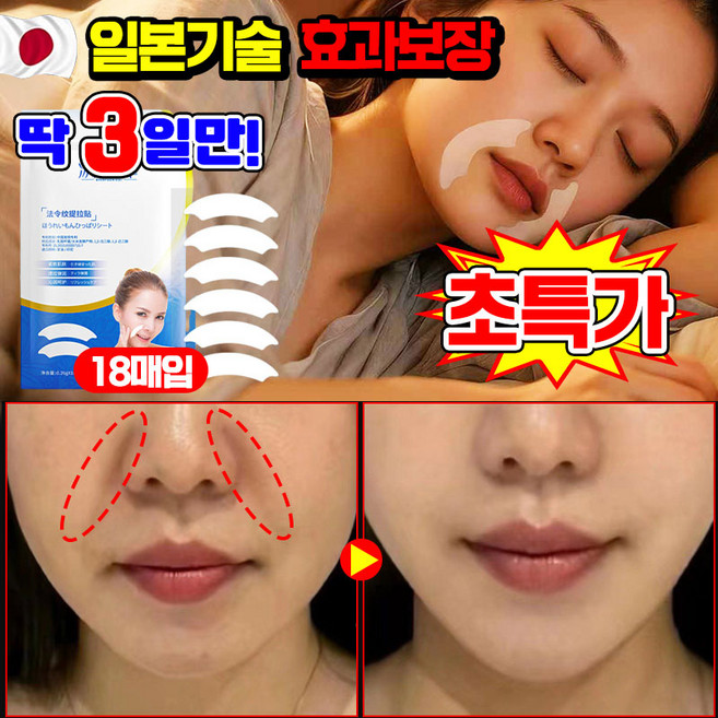 [100% 주름제거] 1/1+1/2+2 레티놀 팔자주름 패치 링클 리페어 주름 패치 팔자주름없애기 미간 이마 입가 잔주름 제거 패치 리프팅 팩 포장증정, 1개, 18개입