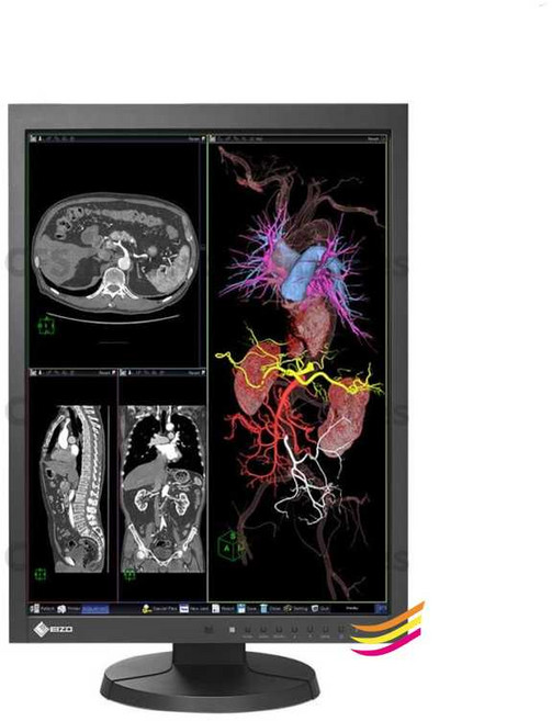21인치 디스플레이 모니터 의료용 병원 치과 판독용, EIZO RX240(A+ 스크린)