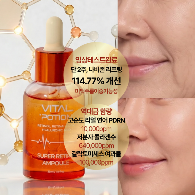 바이탈포션 슈퍼 레티알엔 앰플 고함량 연어 PDRN 10000ppm 탄력 주름 미백 앰플, 33g, 1개