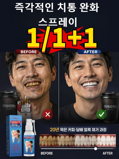 [2/2+2] 잇몸 붓기 통증 등 단숨에 해결 즉각 효과 치통 완화 스프레이 치아 케어 잇몸 붓기 완화 마일드 케어 구강 스프레이 만성 치주염 완화 치통 완, 2개, 20ml
