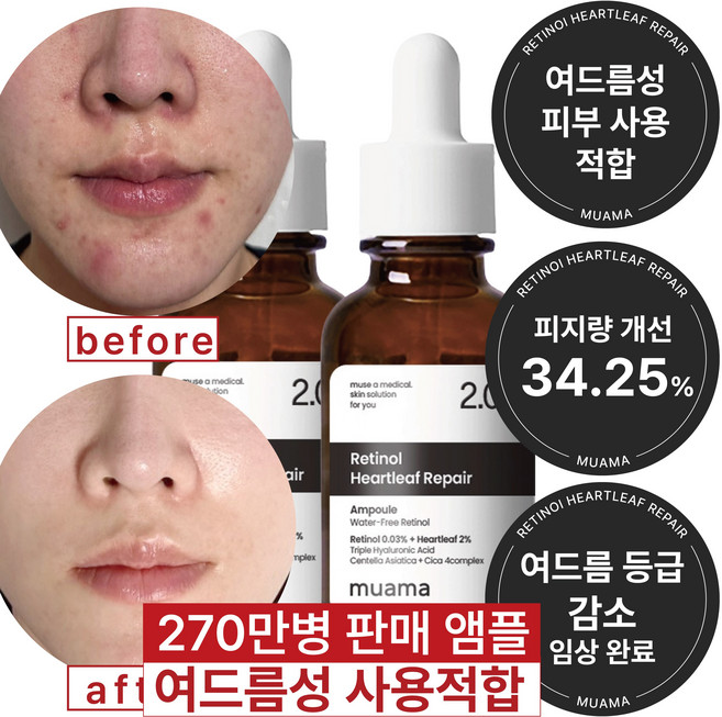 여드름성 피부 사용 적합 사춘기 트러블 진정 개선 흉터 모공감소 피지연화 5종 임상완료 [누적 270만병] 고함량 나이아신아마이드 레티놀 어성초 히알루론산 뮤아마 앰플 세럼, 2개, 30ml