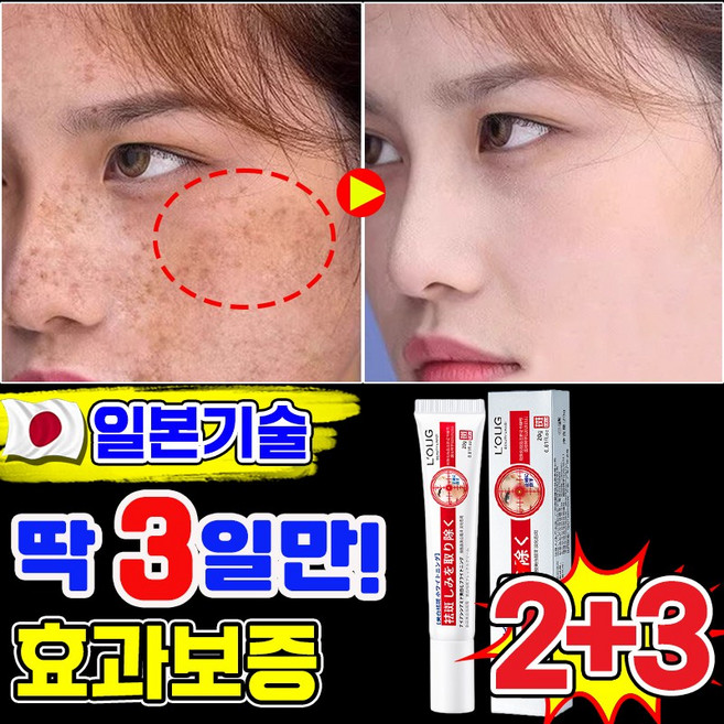 기미크림 기미 잡티 검버섯 흑자 제거크림 멜라논 멜라닌 크림 착색 미백 크림 색소침착 LUPEIYA 포장증정, 5개, 20g