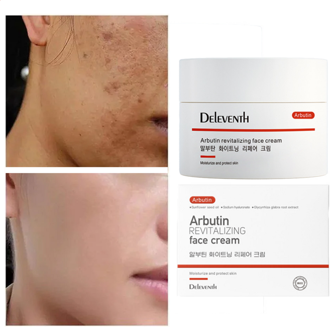 (한국셀러/본토출하) DEleventh 기미제거크림 하얀얼굴 검버섯/강력한 화이트닝 색소침착 개선 토탈케어 미백 크림, 1개, 30g