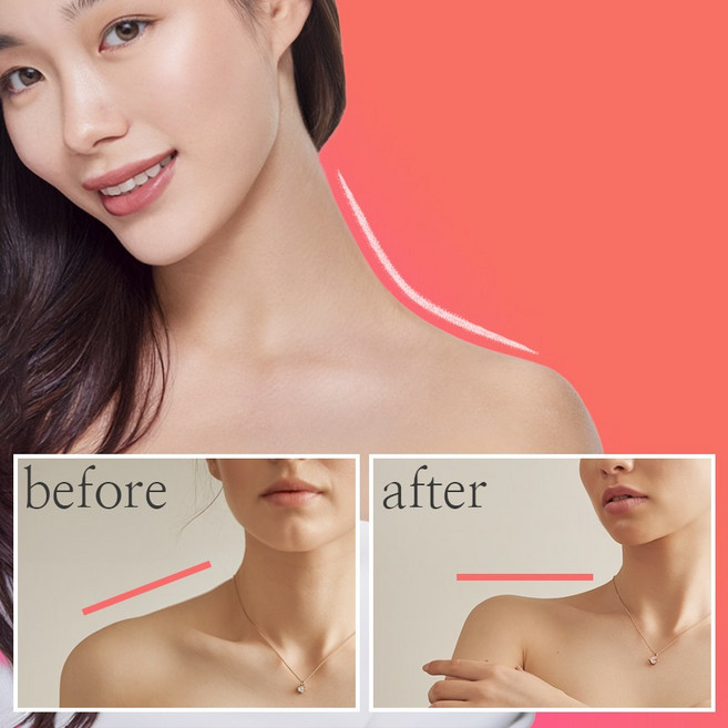 PPC 괄사크림 괄사앤 승모케어크림 승모근 일자어깨 괄사엔, 120g, 1개