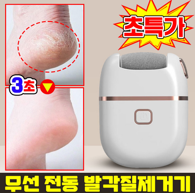 [3초 제거] 무선 전동 발각질제거기 발 뒷꿈치 각질제거기 충전식 발바닥 각질제거기 굳은살 제거 풋케어 발 관리 휴대용 미니 각질 제거기, 1개, 블루