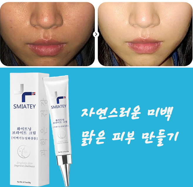 SMIATEY 기능성 기미잡티크림 기미 잡티 앤 기미 케어 주름 미백 크림, 1개, 20g