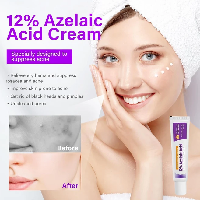 Gurene아젤라익애씨드 12% 함유 크림 트러블로 생긴 잡티 & 모공 관리, 1개, 20g - 쿠팡