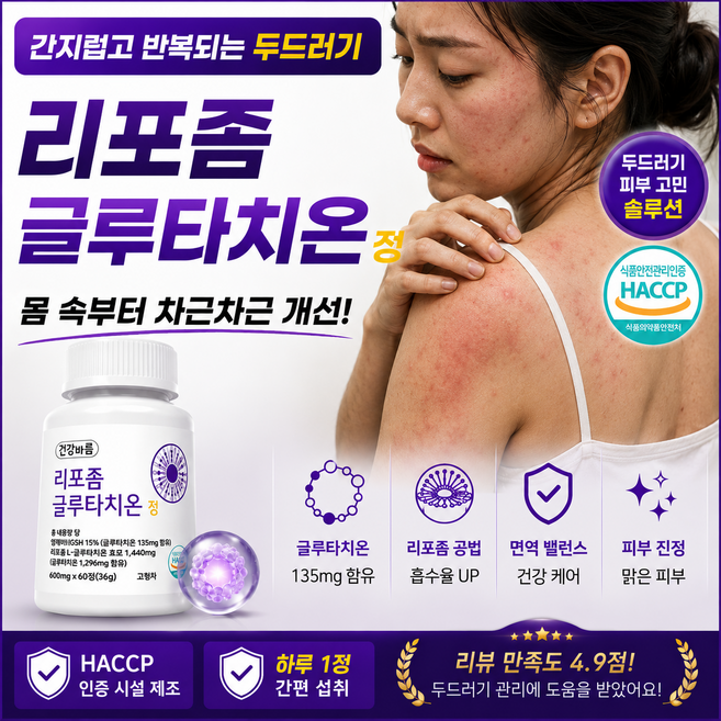 피부 알레르기 두드러기 면역력 가려움증 영양제, 1개, 60정