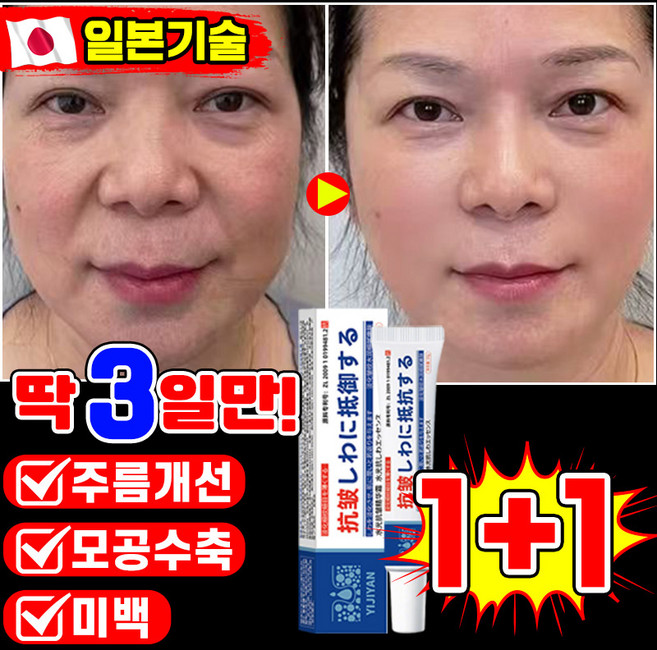 [피부과 추천] 1/1+1/2+2 주름개선 크림 호주 주름크림 눈가 미간 팔자 주름 제거 크림 레티놀 재생크림 탄력 미백 리프팅 안티에이징 LUPEIYA, 2개, 20g