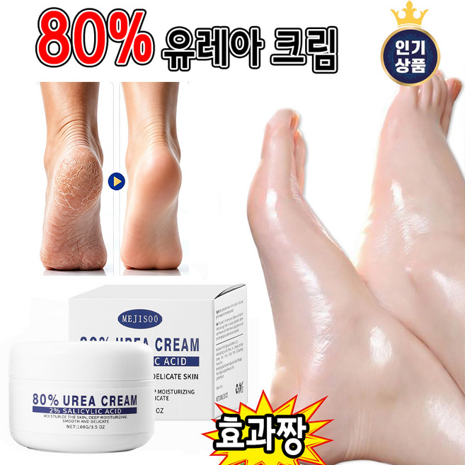 유레아크림 고르는 법 — 구매 전 체크리스트 2026