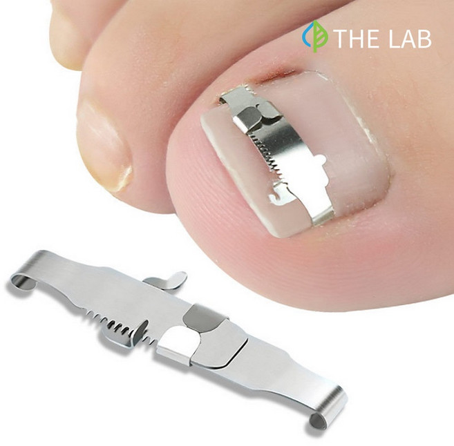 내성발톱 교정기 자가치료 교정 스트립 내향성 관리 기구, 1개