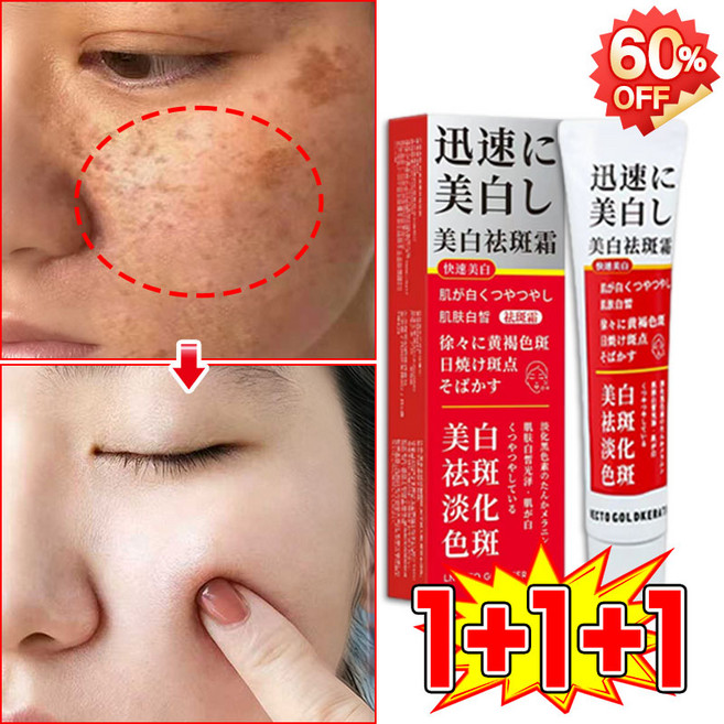 [피부과 추천] 멜라논 멜라닌 크림 기미크림 기미 잡티 검버섯 주근깨 제거 크림 착색 미백 크림 들깨기미크림 색소침착 화이트닝크림 LUPEIYA, 3개, 38g