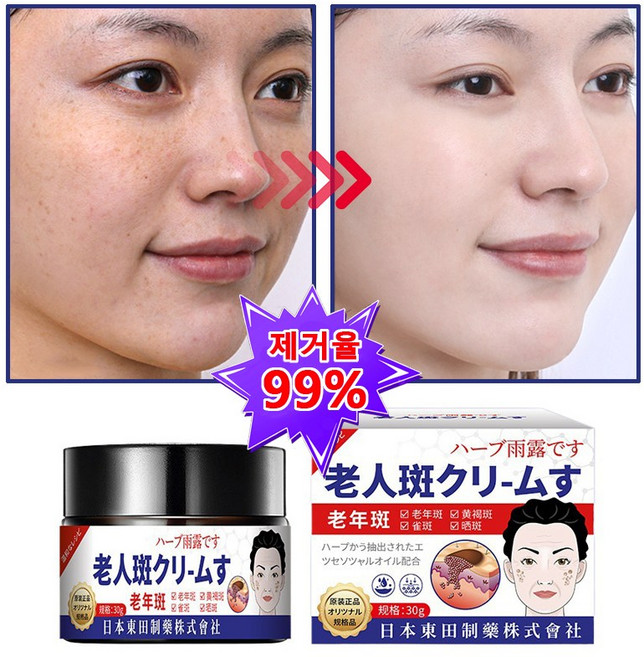 1/1+1 [국내출하 빠른배송] 멜라논 크림 기미크림 착색 미백 크림 색소침착 미백 크림 기미 잡티 주근깨 검버섯 제거, 1개, 29.9g