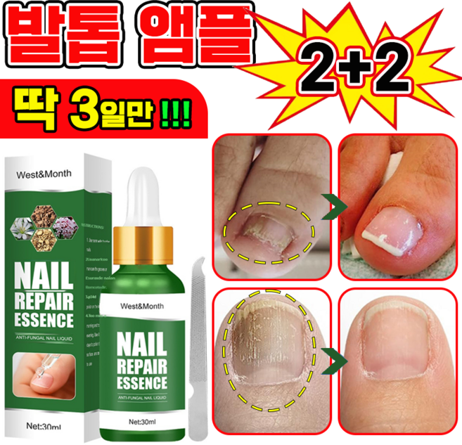 [국내배송] 발톱 거품나는앰플 솔루션 문제성발톱 앰플 발톱 곰팡이 한번에끝내는 손발톱 영양제 보장증정, 4개, 30ml