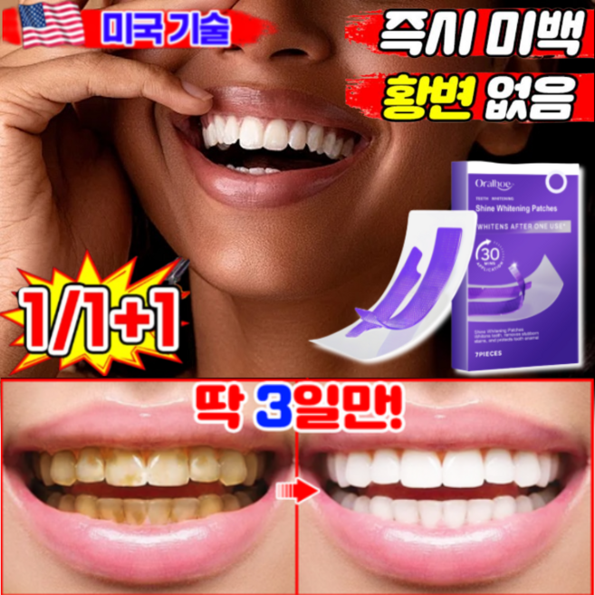 1/1+1 【즉시 미백】치아 화이트닝 스트립 치아미백 패치 셀프 치아미백제, 1개