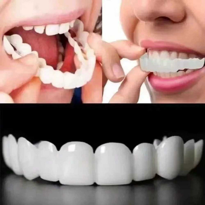 인공 교정기 치아 아랫니 투명 커버 돌출 이빨 수면 앞니 치열 윗니, 하악교정기+치과용박스, 1개