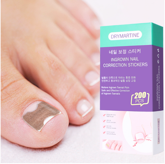 200pcs 내성발톱 밴드 테이프, 1개