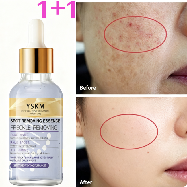 [기미 잡티 제거 크림1위] 기미 검버섯크림 1 여성 멜라토닝크림 고보습 영양크림 미백크림 기미크림 위앰플기미 병풀 기미 고혼진 크림 기미 잡티 미백 잡티 주근깨 검버섯 버섯 흑자, 30g, 2개