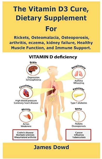 The Vitamin D3 Cure Dietary supplement for Rickets Osteomalacia Osteoporosis arthritis eczema, The Vitamin D3 Cure, Dietary s - 쿠팡