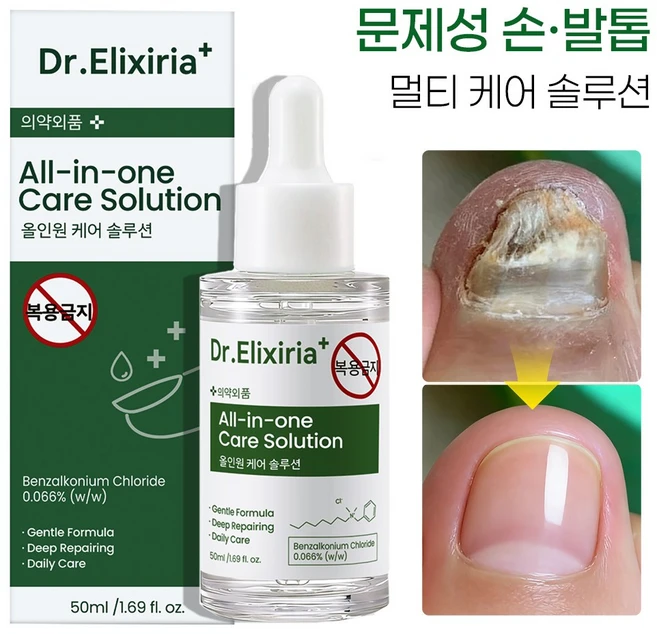문제성발톱 앰플 손 발톱 영양제 관리 앰플 발톱 곰팡이 리페어 세럼 발바닥 발가락 풋케어 솔루션, 1개, 50ml - 쿠팡