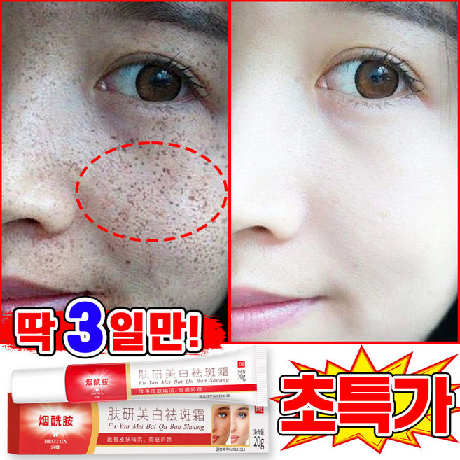 [당일출고] 1/1+1/2+2 기미크림 기미 잡티 검버섯 제거 크림1위 멜라논 크림 착색 미백 크림 들깨기미크림 색소침착 화이트닝 LUPEIYA 포장증정, 1개, 20g