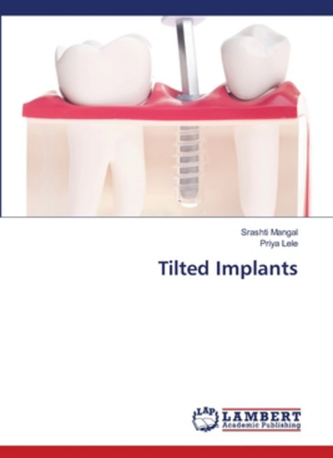 (영문도서) Tilted Implants Paperback, LAP Lambert Academic Publis..., English, 9786207806898
