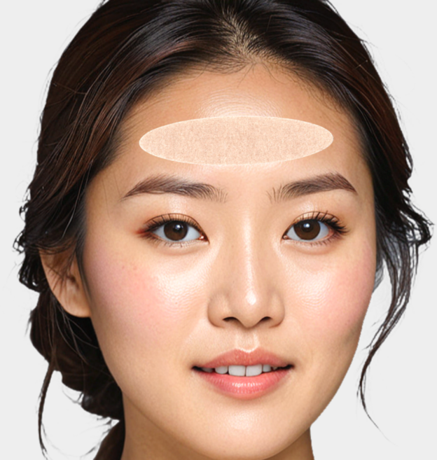 붙이고 자는 랜드윈 실리콘 일반형 이마주름패치 ( feat. 의료용 실리콘 점착제 ), 1개, 12개입