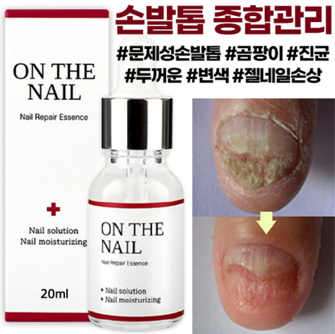 비비룩 온더네일 에센스, 20ml, 1개