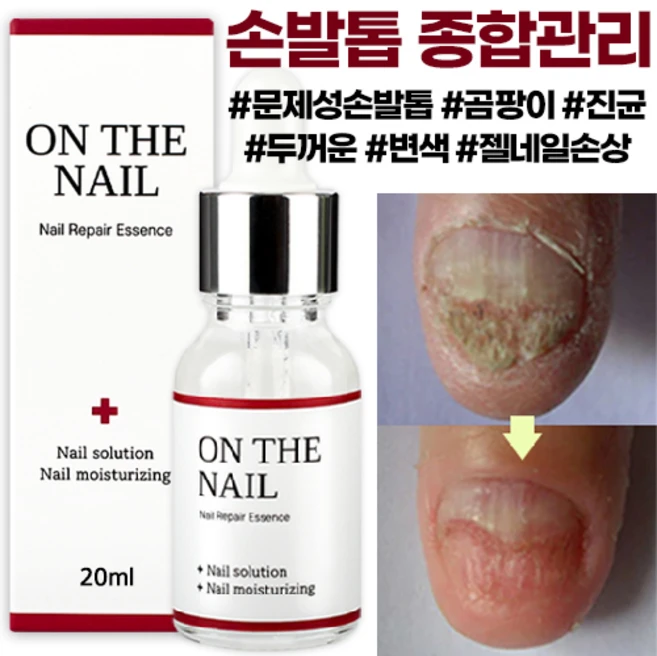 비비룩 온더네일 에센스, 20ml, 1개 - 쿠팡