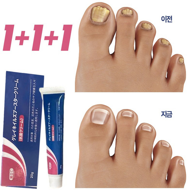 [국내배송] 솔루션 문제성발톱 앰플 발톱 곰팡이 한번에끝내는 손발톱 영양제 발톱 곰팡이 치료제, 20g, 3개, 1개입