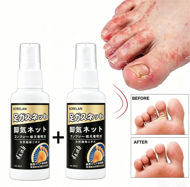 발 케어 스프레이, 30ml, 2개, 1개입
