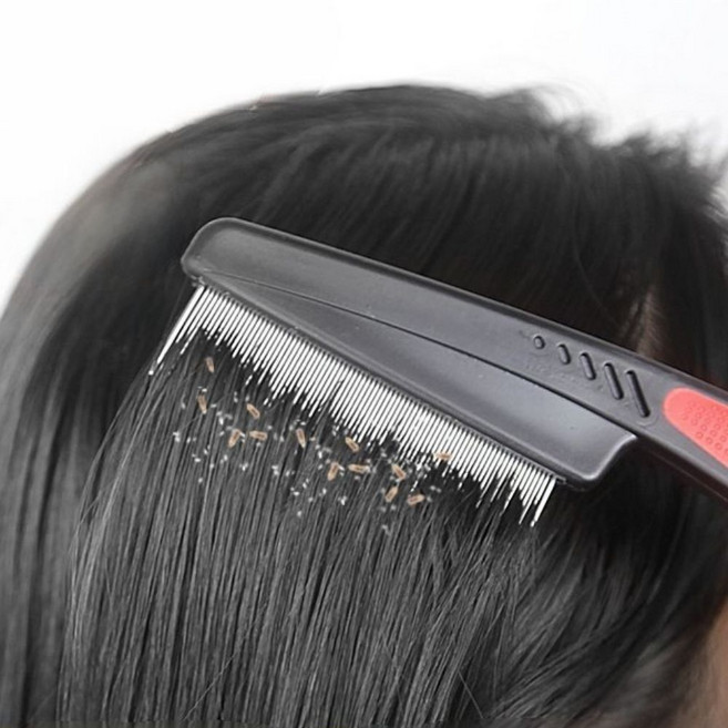 알레노브 머릿니 참빗 고급 스테인리스 빗, 1개, 블랙