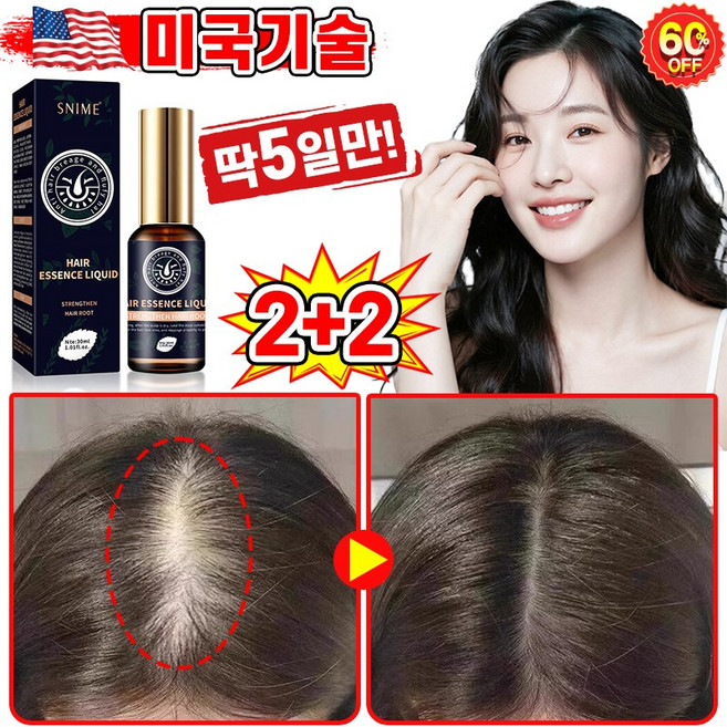 [빠른효과] 미국기술 1/1+1/2+2 두피 영양제 머리 발모제 모발 성장 촉진 에센스 탈모 방지 완화 두피케어 세럼 포장증정, 4개, 30ml