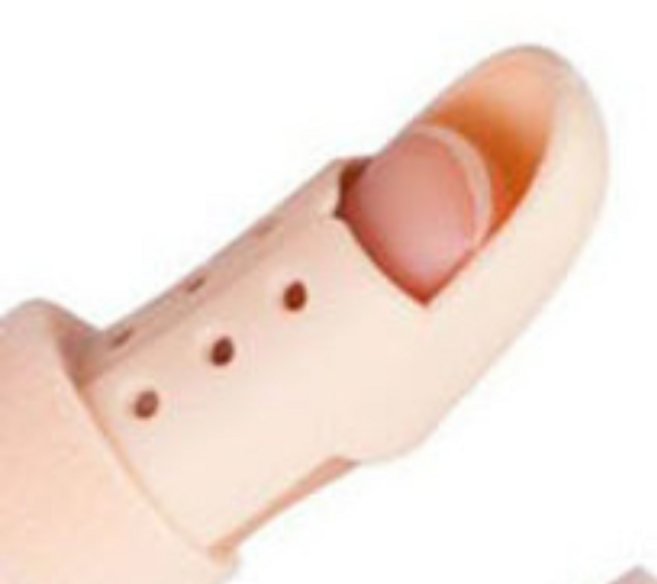 백조목손가락교정기 휜손가락교정기 백조목손가락 손가락휨교정기 새끼발가락골절 새끼발가락휨, 2개