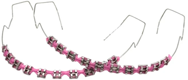 트렌디한 교정기 주얼리 세트 2개 | 화려한 치아 교정기 반짝이 체인 | 소녀 및 청소년을 위한 치아 교, 04 Pink