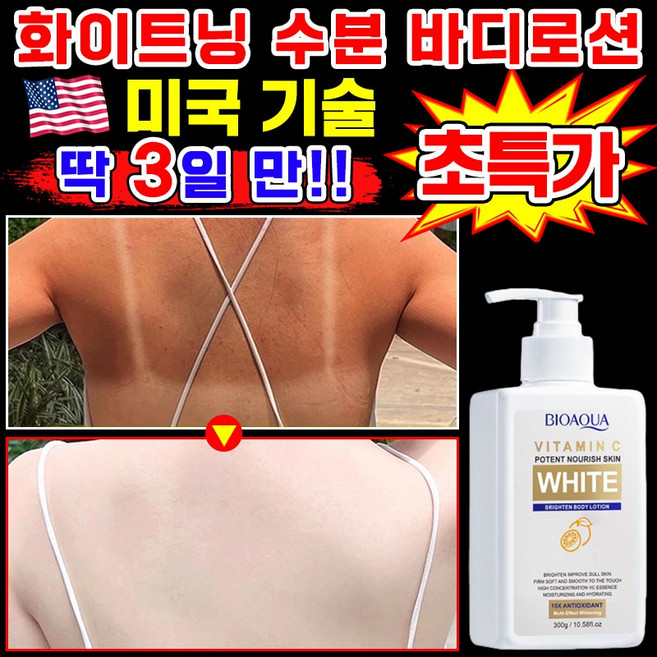 [여름필수템] 미백 수분 화이트닝 바디로션 착색 피부 재생 톤업 크림 팔꿈치 무릎 대용량 스킨 로션 피부 보습제 남자 향 좋은 바디 로션 추천, 1개, 300g