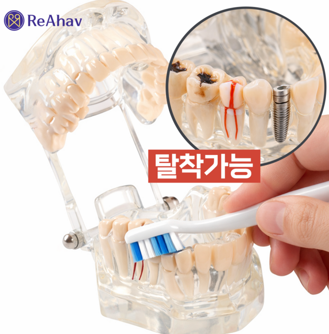 레아하브 클리어덴트 투명치아모형, 1세트