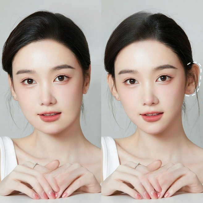 누운 귀 테이프 90p 엘프 요정 세우는 뒤 스티커 교정 리프팅, 1개