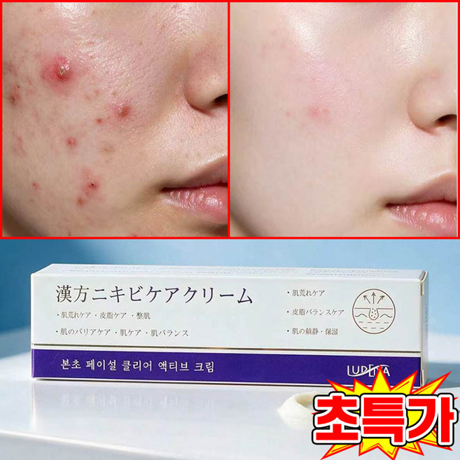 [국내 배송] 여드름 관리 크림 좁쌀 개선 크림 모공 리페어 크림 피지 개선 크림 청소년 LUPEIYA, 1개, 30g