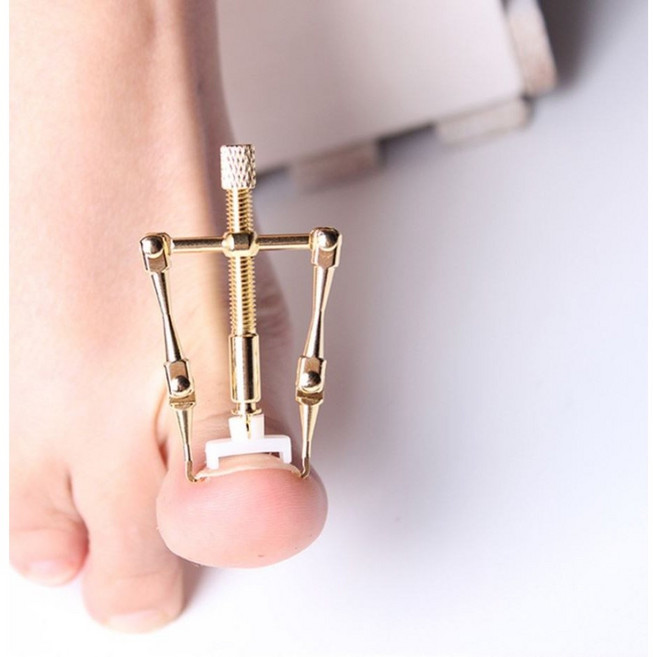 마하 MACH 내성발톱 교정기 의료기기 내향성 발톱 교정 발톱 손톱 들어올리기 목욕후 30분 바른 발톱, 1개