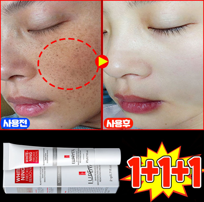 [100% 효과있음] 멜라논 크림 기미크림 기미 잡티 주근깨 검버섯 제거 크림 착색 미백 크림 들깨기미크림 색소침착 화이트닝 LUPEIYA 포장증정, 3개, 21g