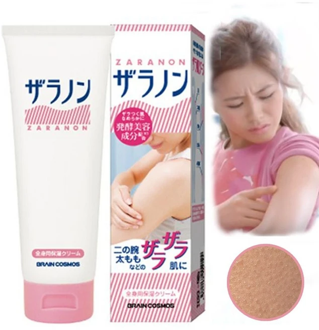 자라논 닭살 피부 바디 로션 크림 보습 등 팔 우레아 ala+821mH - 쿠팡